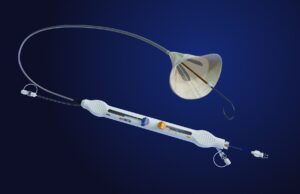 EMBLOK enrols 50th patient in TAVR embolic protection trial