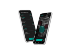 Novel AI-assisted DVT diagnostic pathway aims to ‘democratize’ point-of-care ultrasound