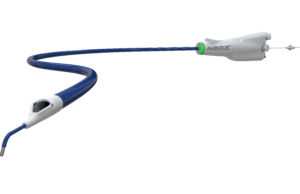 AVENTUS trial of thrombectomy system for PE treatment completes enrolment