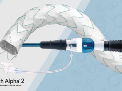 Cook Medical announce first US patient treated with Zenith Alpha 2 endovascular graft cook medical