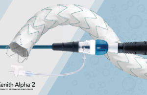 Cook Medical announce first US patient treated with Zenith Alpha 2 endovascular graft cook medical