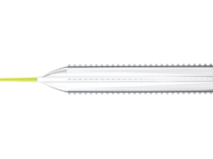 Cagent Vascular initiates patient enrolment in Serranator vs. plain balloon angioplasty OCT study Serranator