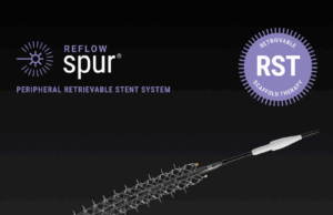 US FDA grants de novo clearance for Reflow Medical’s Spur peripheral retrievable stent system