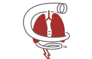 Penumbra’s STORM-PE randomised trial completes enrolment penumbra