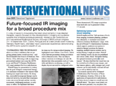 Future-focused IR imaging for a broad procedure mix Siemens Healthineers