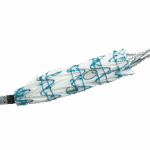 Fenestrated Treo web