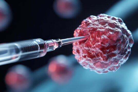 Cryoablation gains ground as effective alternative treatment for T1a renal cell carcinoma in EuRECA registry interim analysis cryoablation