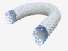 Clinical trial of covered stent graft for dialysis access dysfunction completes enrolment