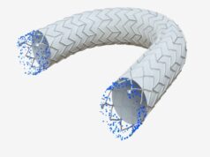 Clinical trial of covered stent graft for dialysis access dysfunction completes enrolment
