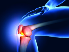 Interrupting the pain cycle: The expanding role of MSK embolization in chronic joint pain MSK embolization