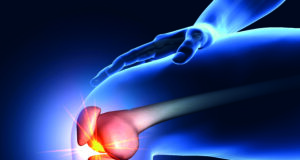 Interrupting the pain cycle: The expanding role of MSK embolization in chronic joint pain MSK embolization
