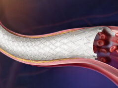 BD receives CE mark for Revello vascular covered stent
