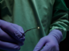 Vena Medical secures US FDA clearance for MicroAngioscope system