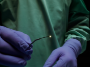 Vena Medical secures US FDA clearance for MicroAngioscope system