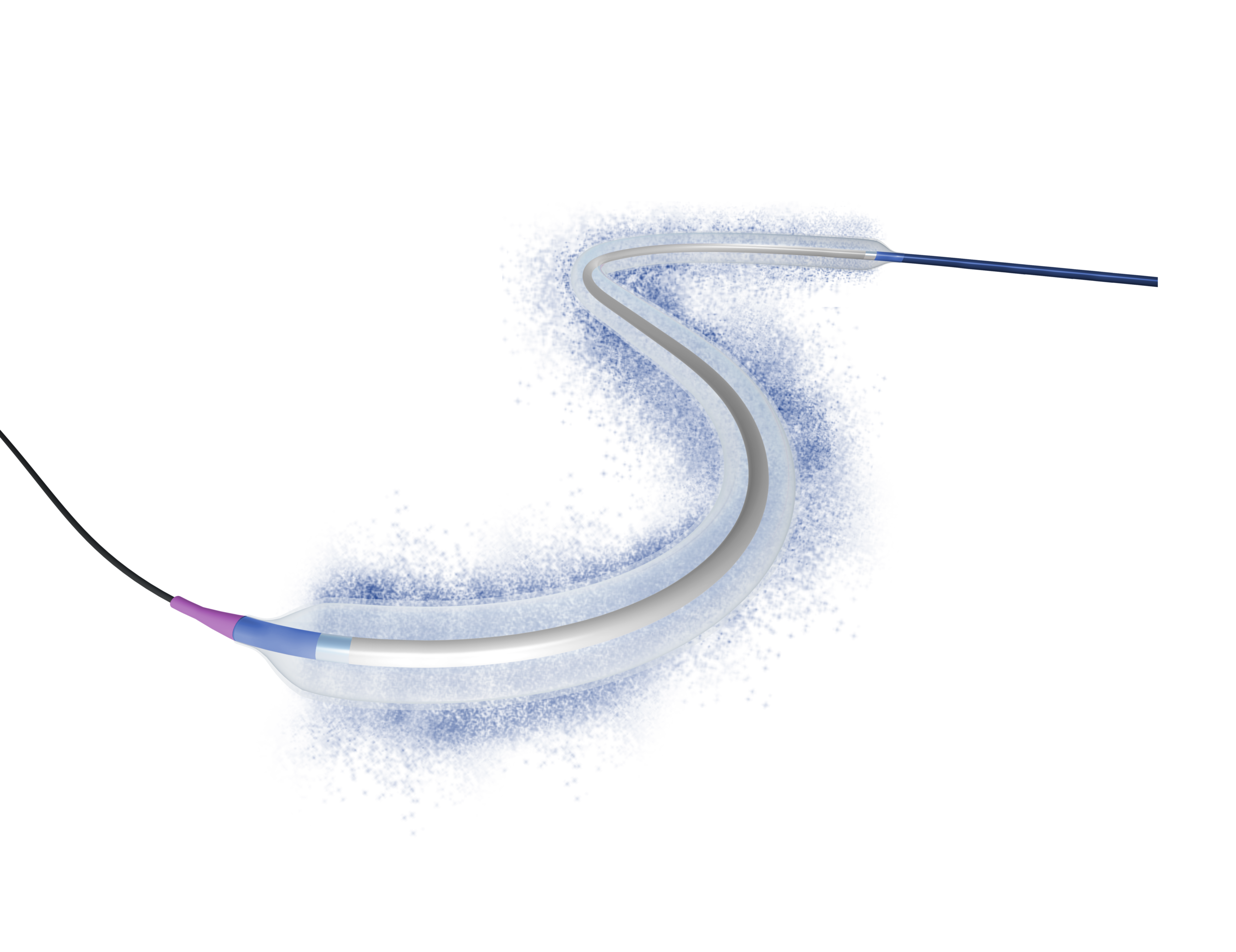 LUMIFOLLOW registry shows sustained three-year performance of Luminor in femoropopliteal disease