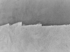 “Therapeutic borderlands”: Do patients know their options? patient-centred care, IR