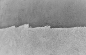 “Therapeutic borderlands”: Do patients know their options? patient-centred care, IR