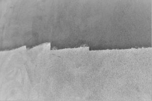 patient-centred care, IR