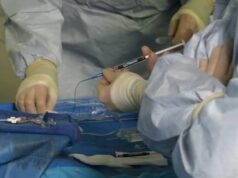 Fluidx Medical announces first patient treated with novel embolic gel