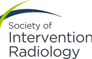 New Society of Interventional Radiology guideline endorses PAE for treatment of enlarged prostate SIR