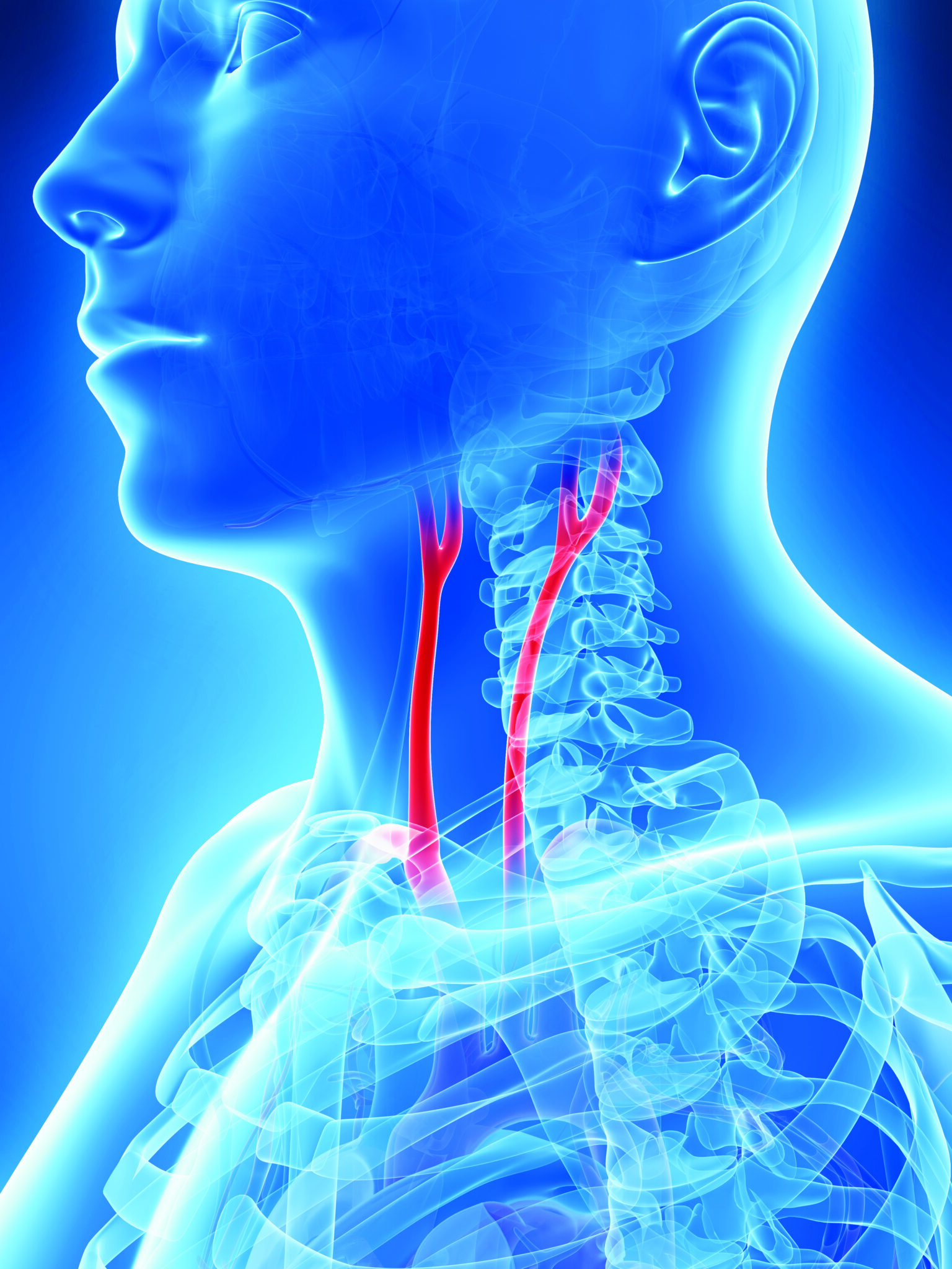 Editorial argues carotid stenting has reached “prime time” following CREST-2