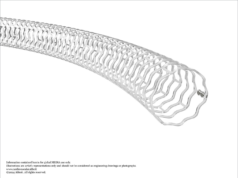 Abbott secures CE mark for longer-length Esprit BTK system