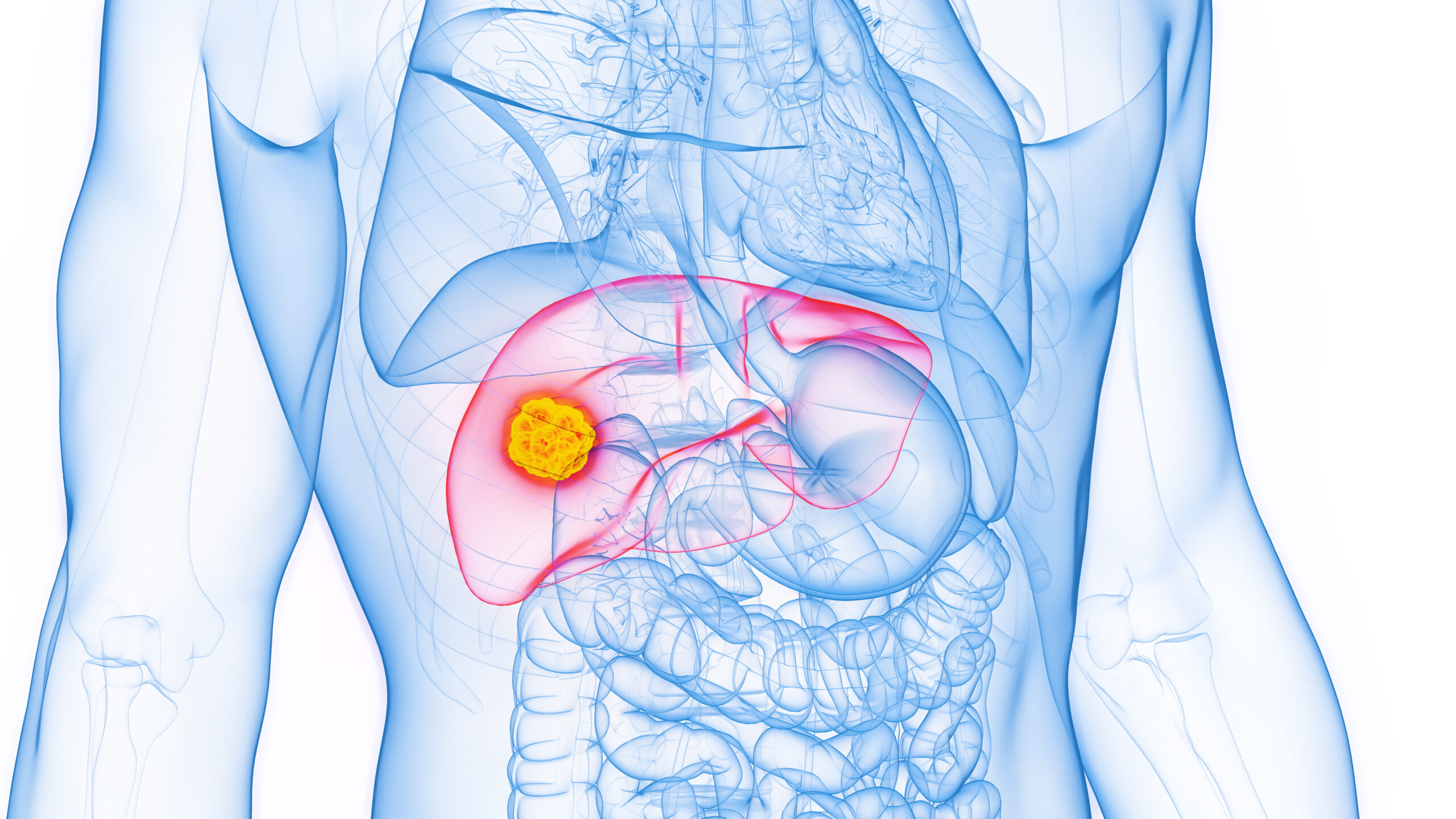 IR “most utilised” specialty for HCC, finds 25-year multidisciplinary analysis